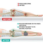 23352_PS_03_Knee_pillow_MemoSilver_VitaSpine_WEB_ENG