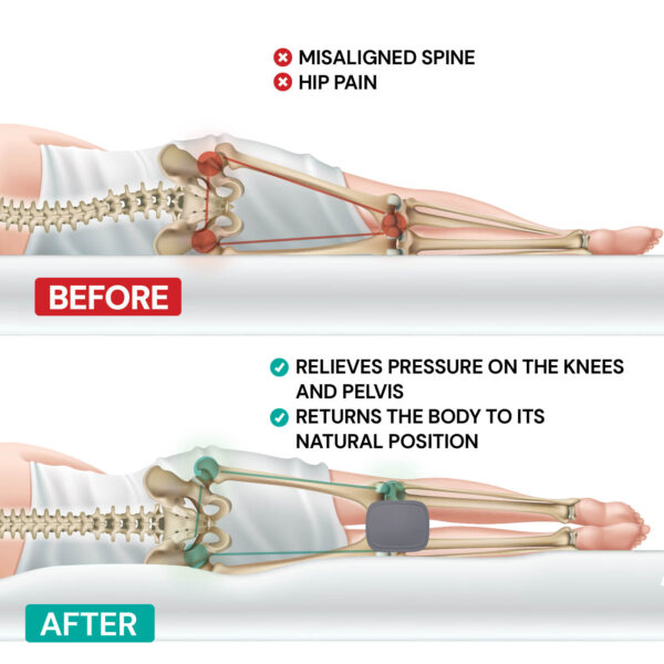 23352_PS_03_Knee_pillow_MemoSilver_VitaSpine_WEB_ENG 23352_PS_03_Knee_pillow_MemoSilver_VitaSpine_WEB_ENG